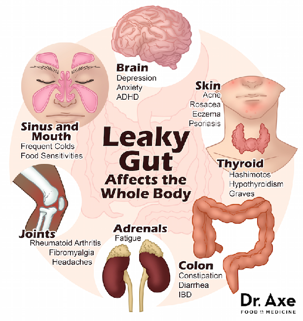 Leaky Gut Syndrome a real disease entity? The Namibian